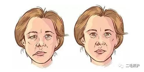 为什么天气热会引起面瘫呢,老年人风吹一下会导致面瘫吗