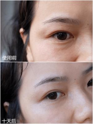 经常敷面膜有什么改善,经常敷面膜皮肤看起来还是很差