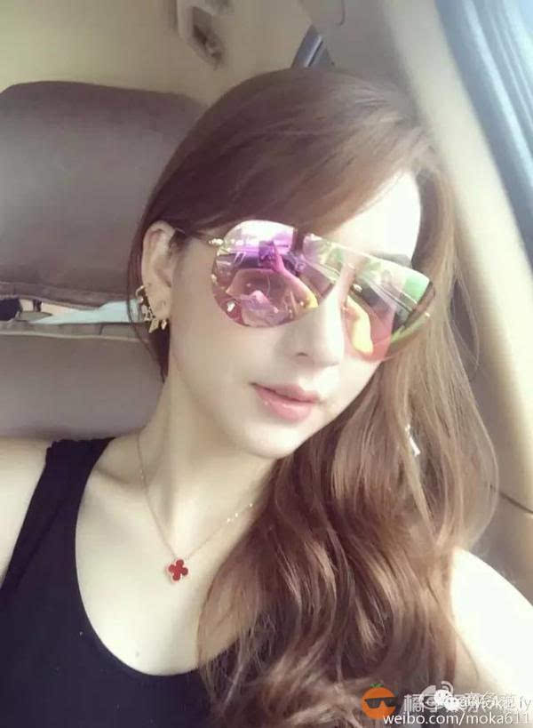 网红玻尿酸,为什么网红都打玻尿酸