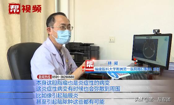 右眼皮长期跳是脑瘤,眼皮跳的频繁是颅内肿瘤的预兆吗