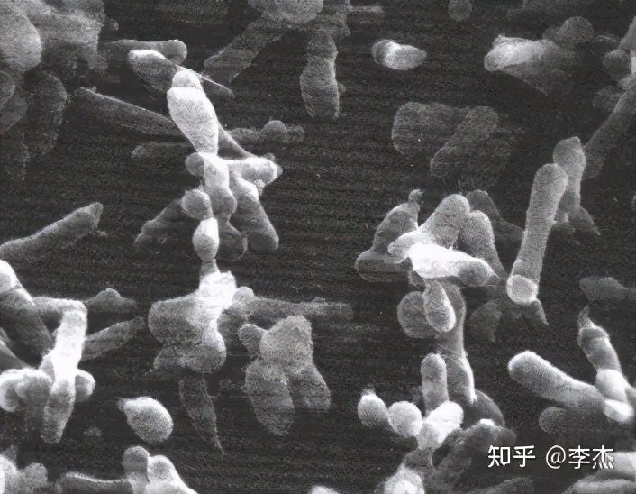 细胞培养出现链球菌污染怎么办,细胞培养如何应对支原体污染