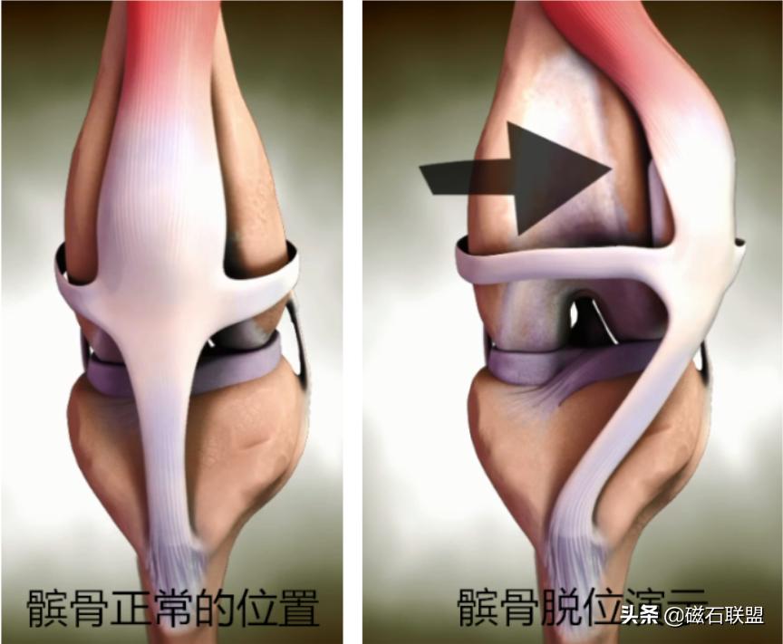 泰迪犬后腿一瘸一拐的怎么回事,泰迪犬性格缺陷