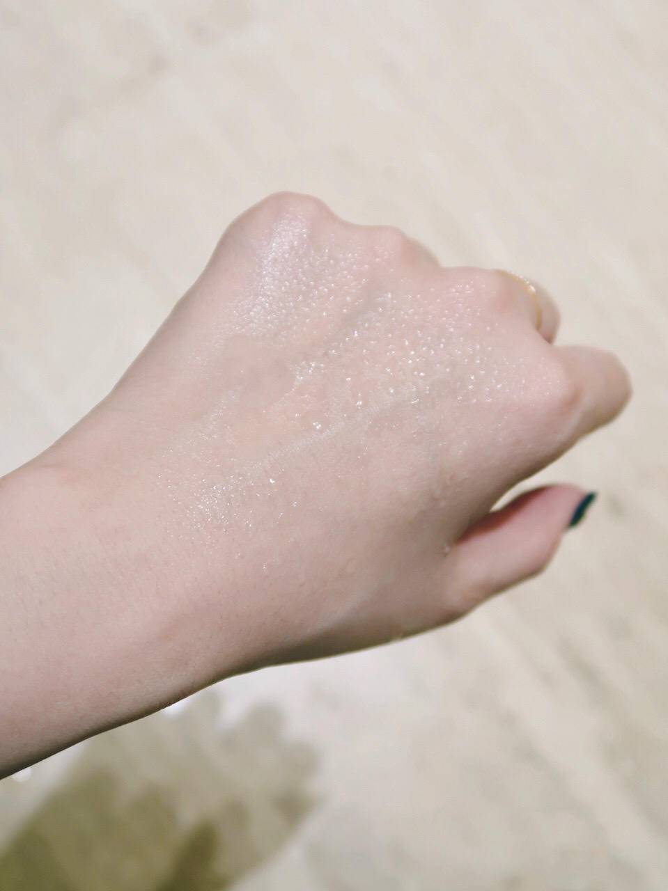 晒后晒伤发红修复最有效的办法,晒后修护可以涂抹晒伤的皮肤吗