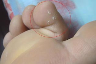 把牙膏涂在脚底会发生什么,牙膏抹在脚底有什么作用