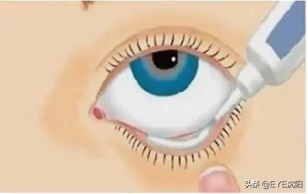 怎样才是滴眼药水正确方法,眼药水的顺序用错了如何补救