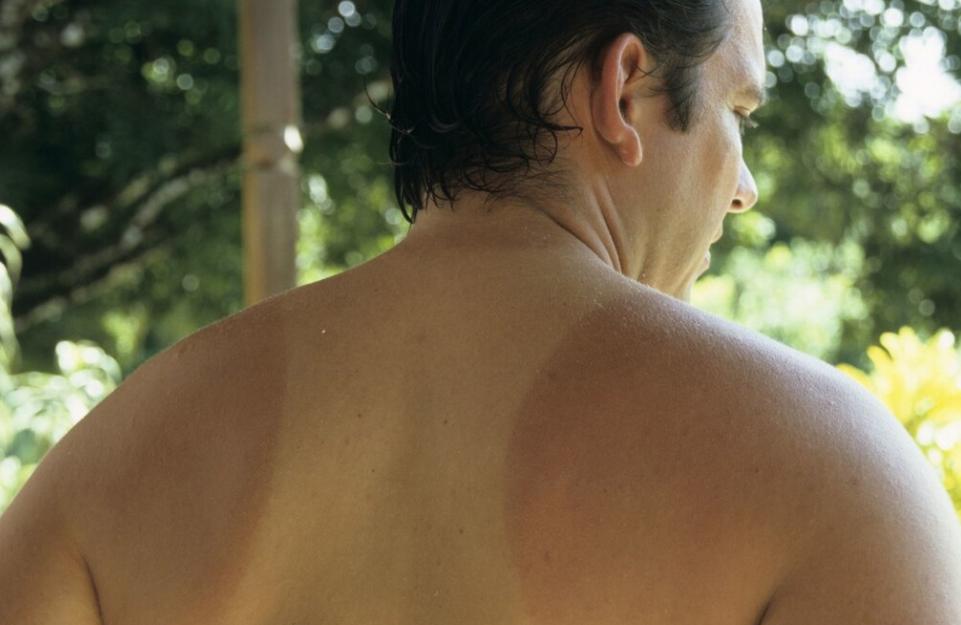 一个月教你皮肤变白,皮肤黑怎么能简单实用变白