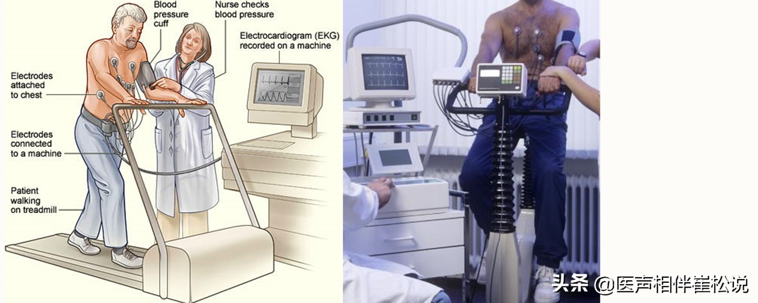 心电图上t波改变啥意思,心电图上t波改变