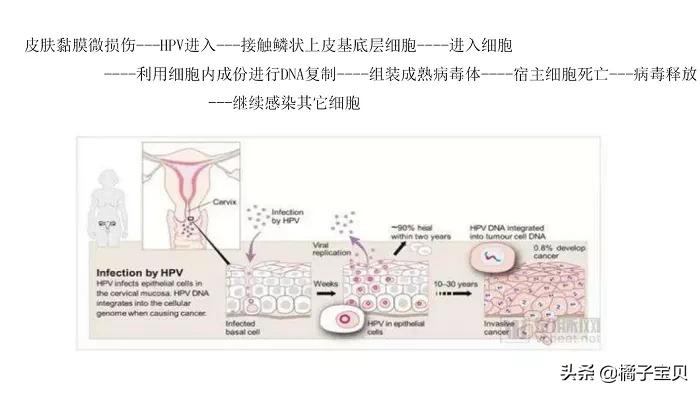 女人宫颈感染hpv的症状,女性宫颈hpv如何感染