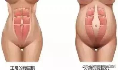 产后修复知识大全书本,科普产后康复有必要做吗