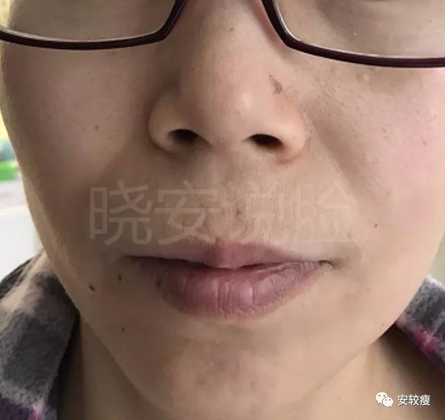 熟龄肌抗皱护肤品,35岁以上好用的抗老抗皱紧致测评