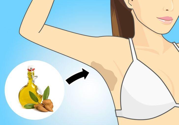 腋下黑快速补救,腋下发黑用什么药物可以去除