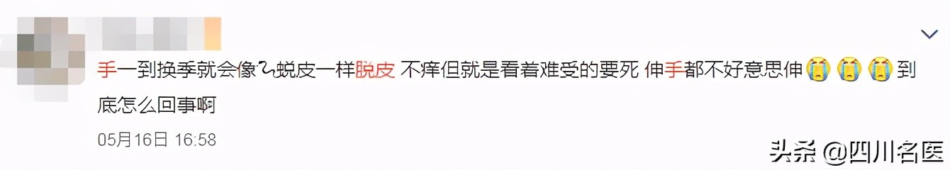 你的手指上为什么会脱皮,您的手为什么会脱皮