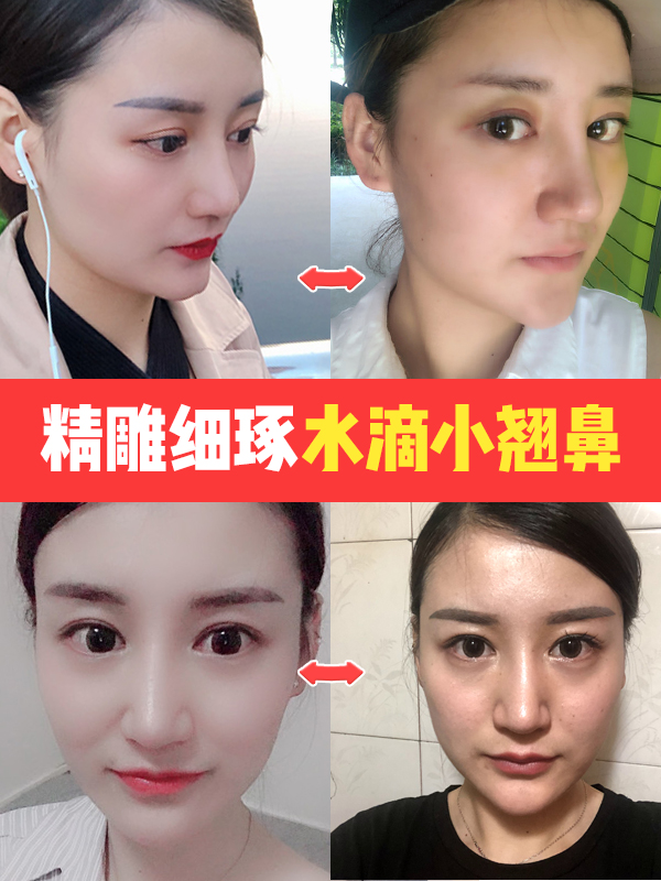 隆鼻之后不好看怎么办,隆鼻后发现很假怎么办