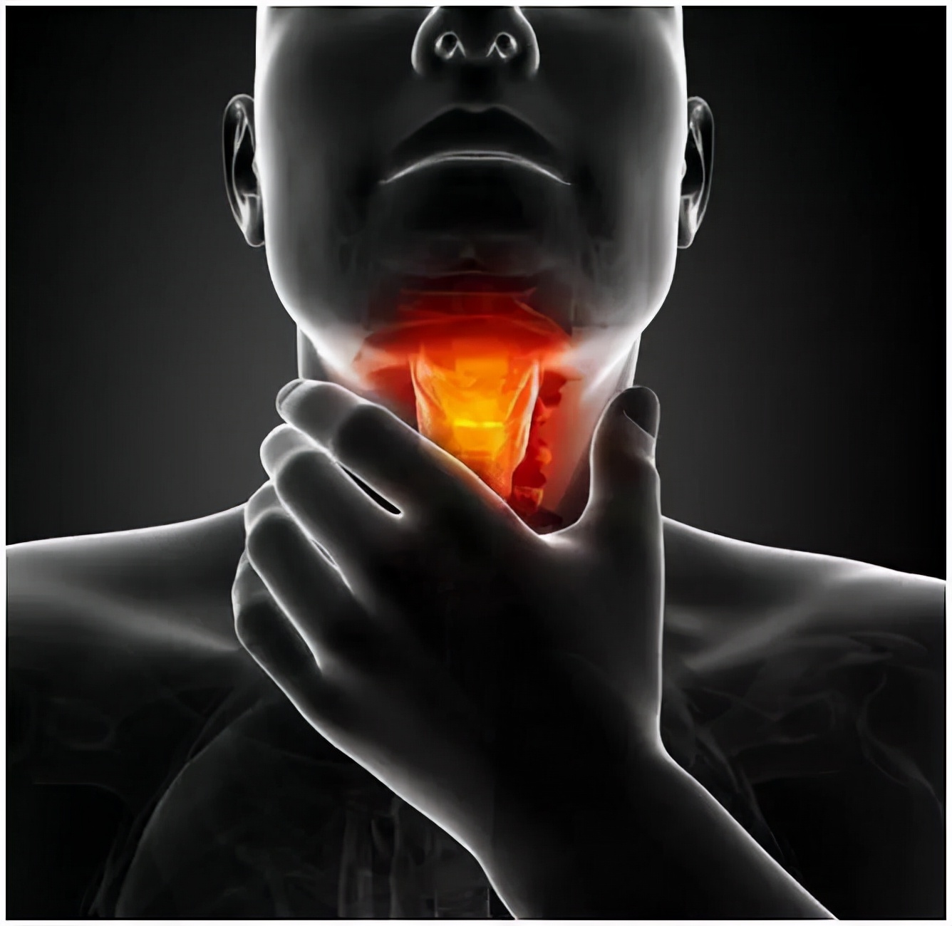 声门下型喉癌晚期排查,喉癌自测的5个征兆