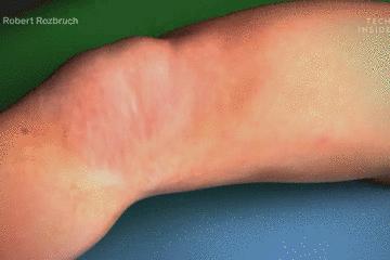 医生手术后最想做什么,医生做完手术以后会怎样