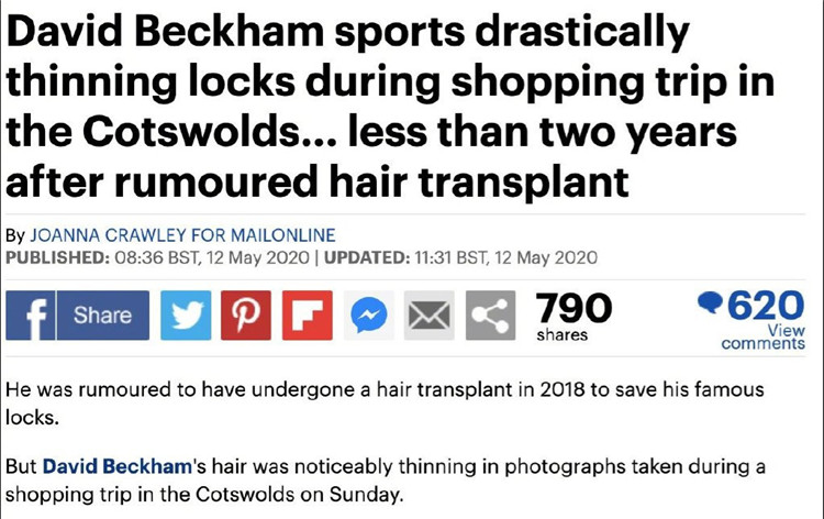 贝克汉姆头秃,贝克汉姆秃了头