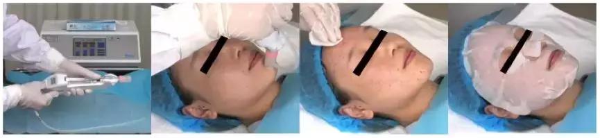 美容针讲解视频,美容针解析