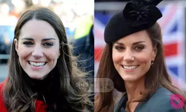 颅顶太低如何自救,颅顶低怎么自救