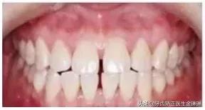 诺尔口腔牙齿矫正怎么样,淄博诺尔漫口腔