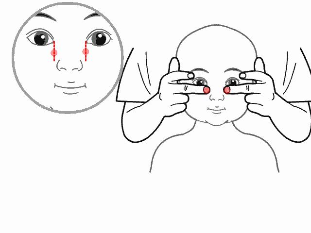 宝宝鼻塞20秒自愈方法,一岁半宝宝鼻塞快速解决方法