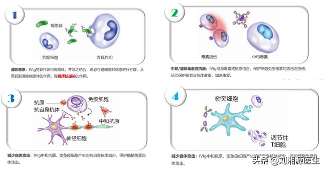 丙种球蛋白妊娠,静脉注射免疫球蛋白保胎