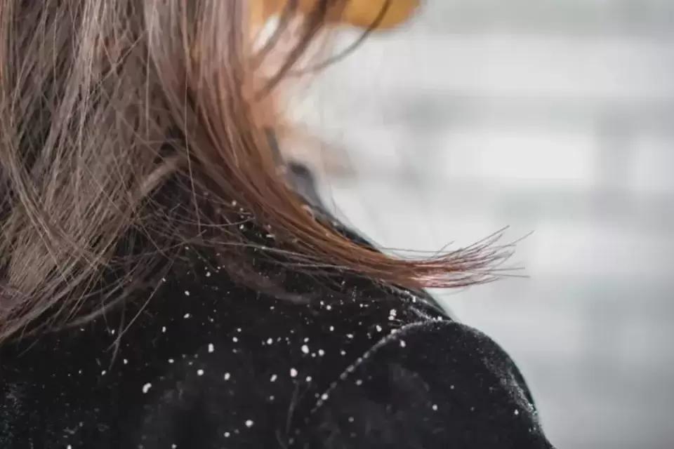 假发超稳固怎么佩戴,假发片怎么戴才没有痕迹