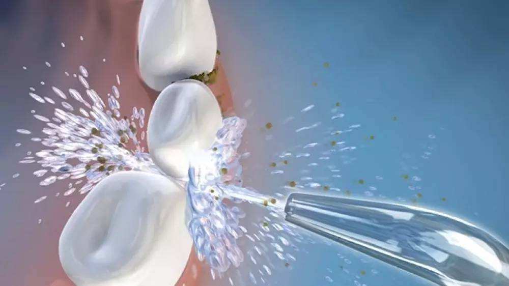 怎么让龋齿咬东西不痛,龋齿大部分被腐蚀了怎么办