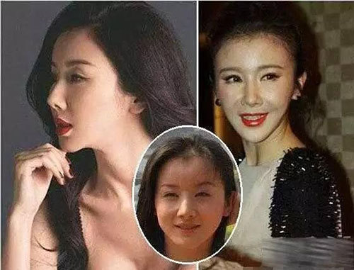 那些一刀切削骨的明星还好吗？后遗症一大堆，小方脸成最大赢家
