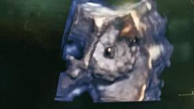 小心眼小妙招,改掉小心眼的小妙招