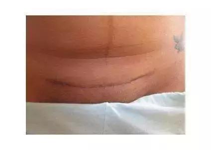 世上最丑的“微笑”……你不喜欢拥有它,但它的伟大无可否认!