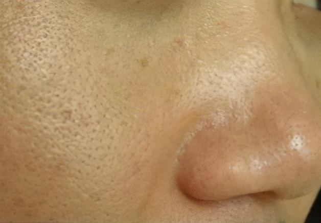 jm面膜燕窝精华好用吗,鱼子酱面膜和燕窝面膜哪种好用些