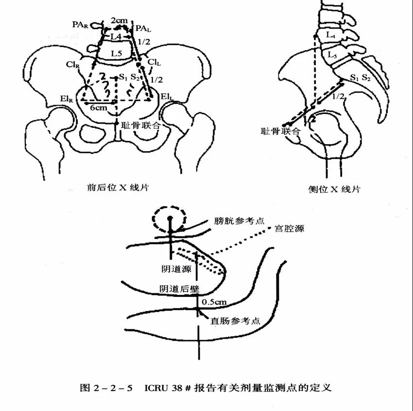 什么是近距离交叉口,什么是近距离用眼时间