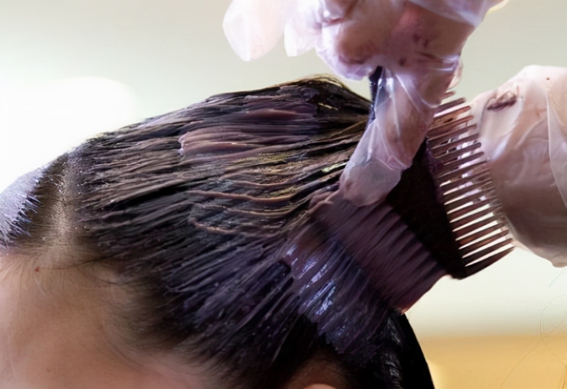 白发的引起原因和白发调理方法,发量稀少如何调养