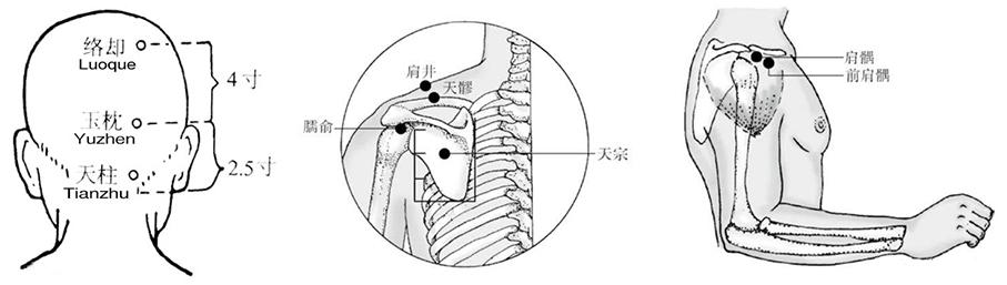颈椎病脖子咔咔响怎么治,转动颈椎咔咔响真的是颈椎病吗