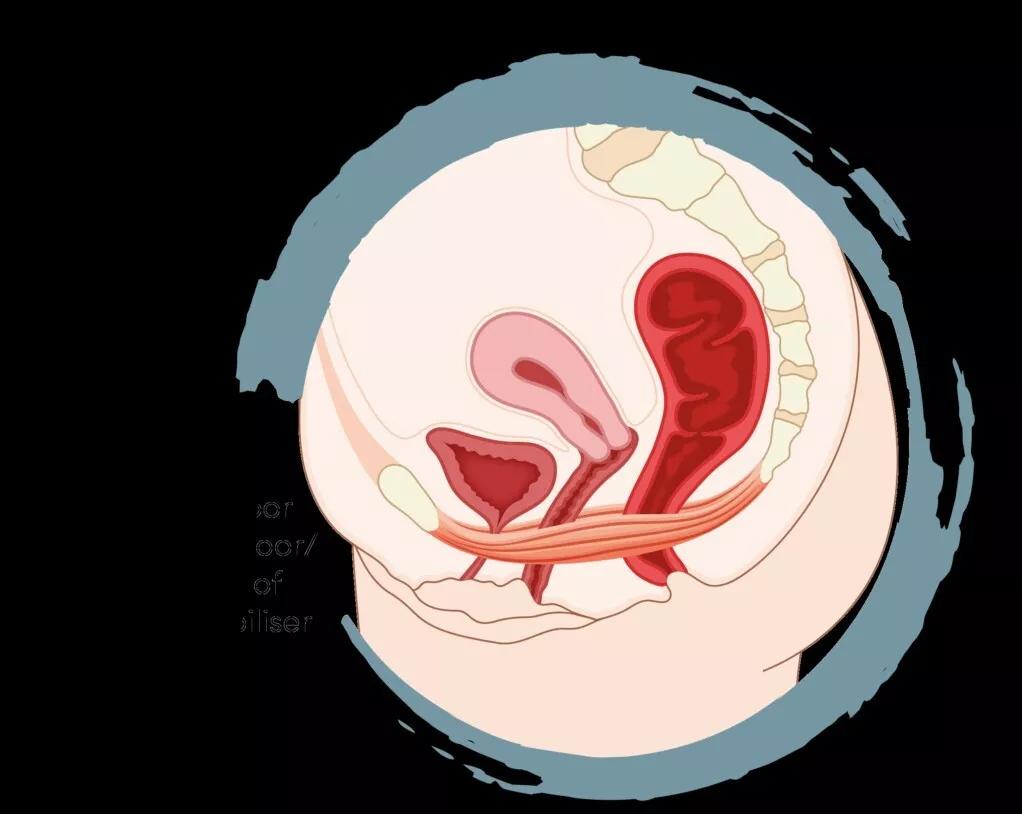 被自己吓哭的女孩,盆底康复难言之隐