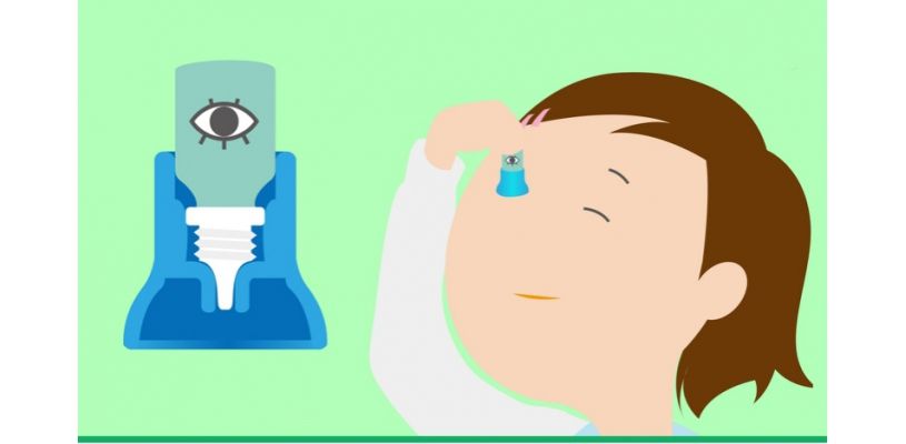 胶水进眼睛里面医生怎么处理,胶水误入眼睛怎么办