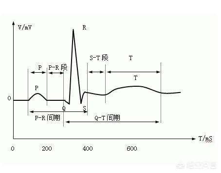 体检心电图t波异常怎么办,心电图检查t波改变是心脏病吗