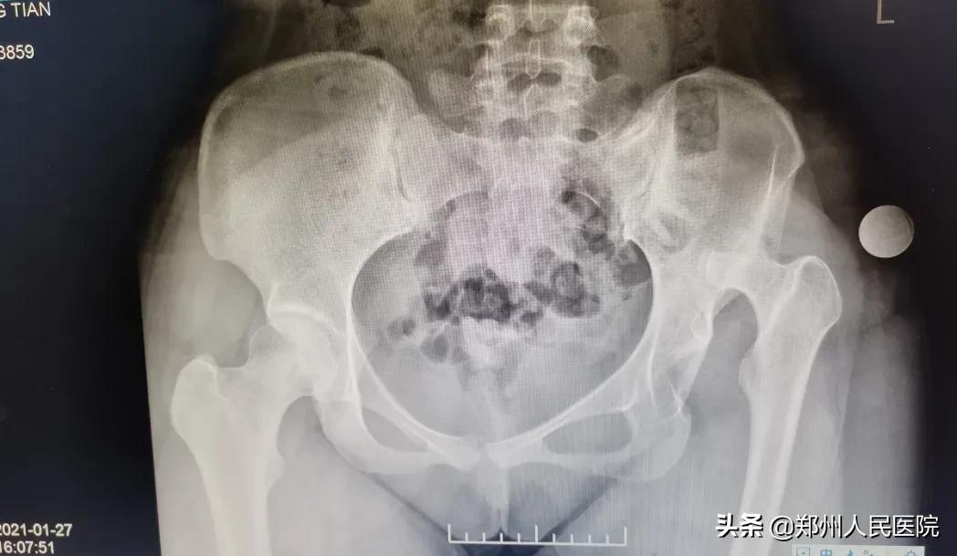 走路像鸭子一样摇摆,走路像鸭子的样子