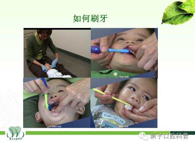 补牙齿龋齿全过程,补龋齿怎么做到无痛