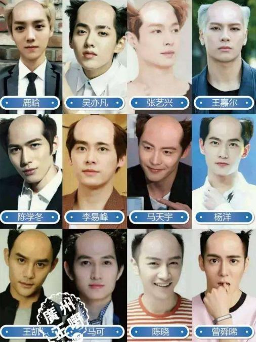 面对脱发如何调整心态,当代脱发的自救方法