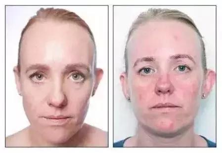 性价比卸妆水排行榜10强,高性价比卸妆产品推荐