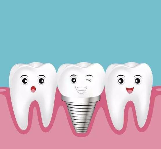 雅悦齿科杨浦雅洁口腔医院,雅悦齿科种牙