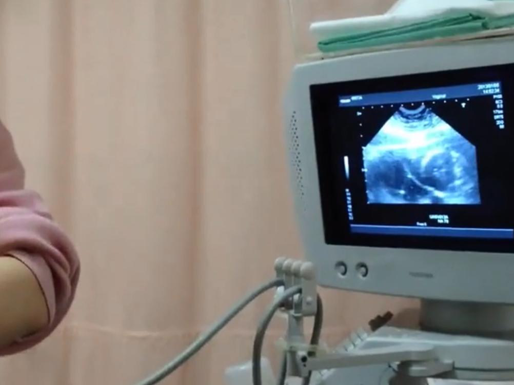 让孕妇妈妈提心吊胆的羊水穿刺,孕妈必须知道的羊水穿刺问题收藏