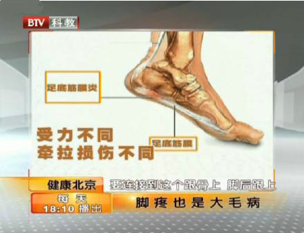 肌筋膜炎如何治疗,肌筋膜炎输液治疗能治愈吗