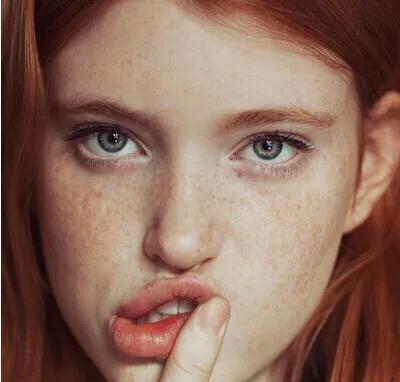 雀斑一扫而光,雀斑怎么才能让它变淡