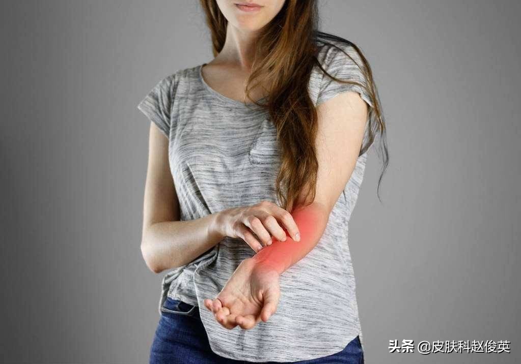 皮肤抓挠引起的皮炎怎么治疗,瘙痒性皮炎怎么治