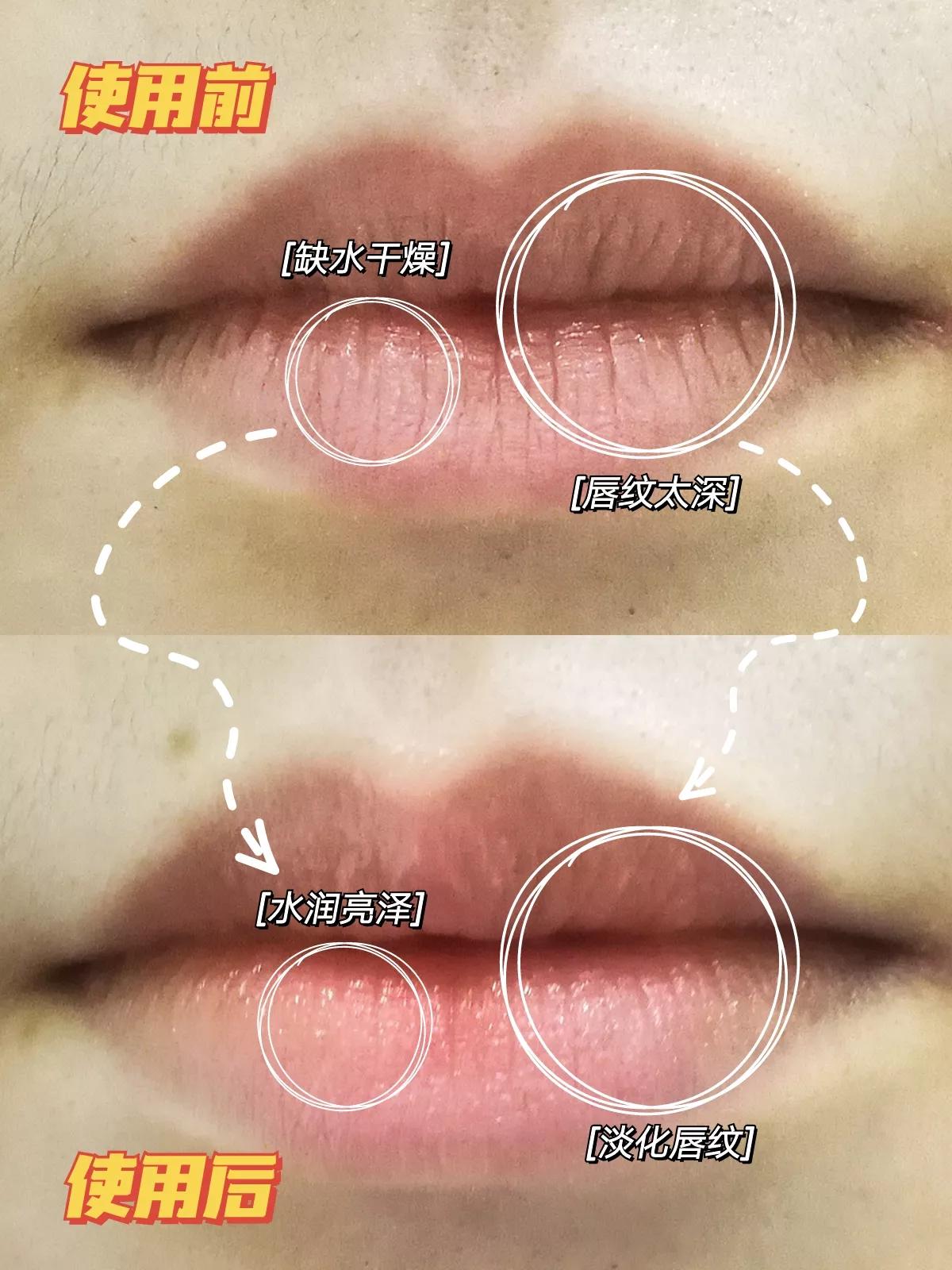 唇膏保湿滋润补水第一名男士,男士淡化唇纹的唇膏推荐