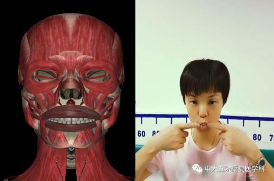 面瘫临床表现的科普视频,科普面瘫多久治疗效果最好