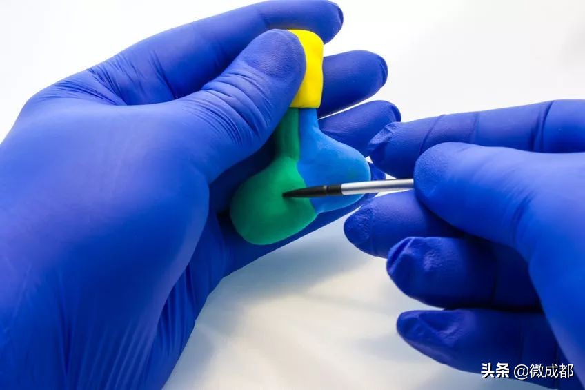 男性泌乳素型垂体大腺瘤严重吗,男人得了泌乳素垂体瘤严重吗