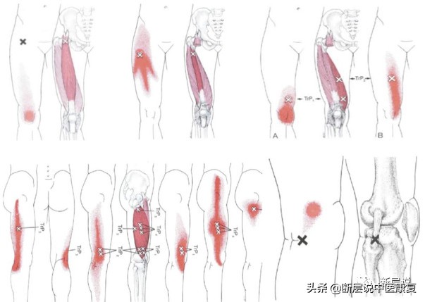 天气冷运动护膝推荐哪种,天气冷了保暖护膝